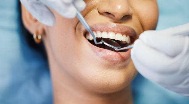 Best Broken Tooth Emergency  in Bowling Green, OH