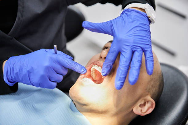 Best Knocked-Out Tooth Emergency  in Bowling Green, OH